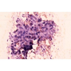 TINCION CITOLOGICA (3 X 200ML) - Equinvest